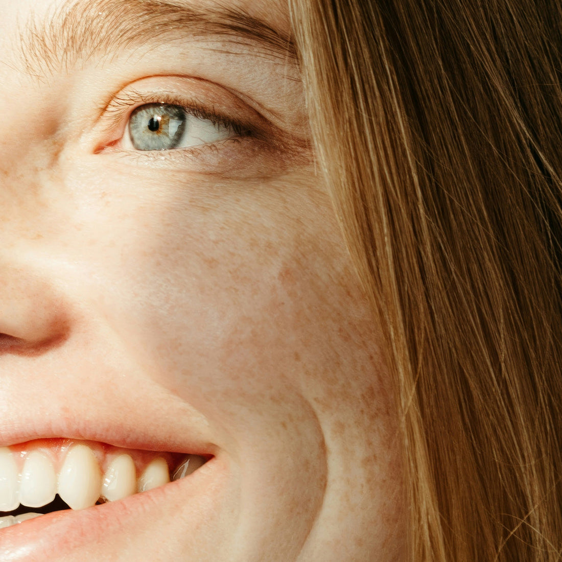 Why does pigmentation keep coming back?